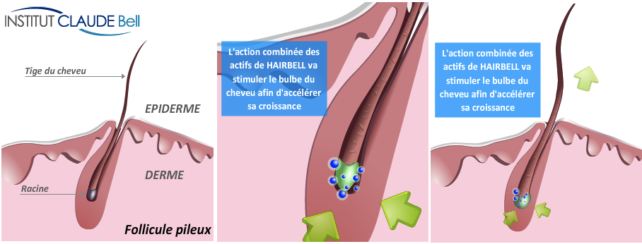 Le traitement de la croissance des cheveu pour le terme court
